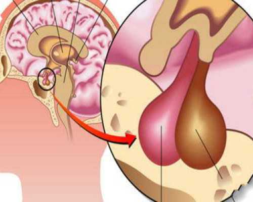 调经、促进受精卵着床，服用补佳乐的好处和坏处一览