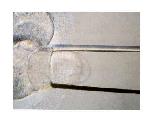 三代试管生女孩的价格多少钱？附详细费用清单