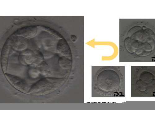 南宁靠谱的供卵机构_　女孩，女孩，女孩！