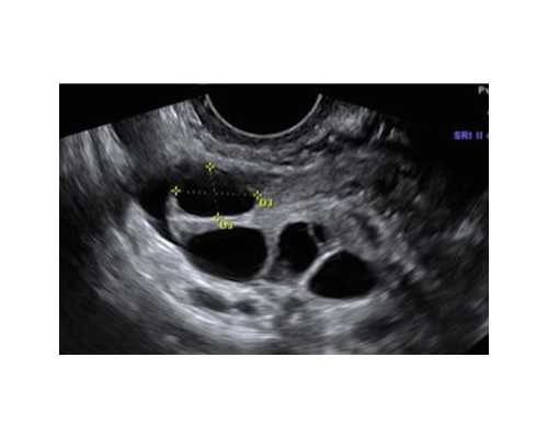 黑龙江试管供卵中心_新生儿猛涨期是什么时候