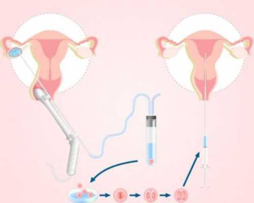 宫体炎与宫颈炎区别有哪些