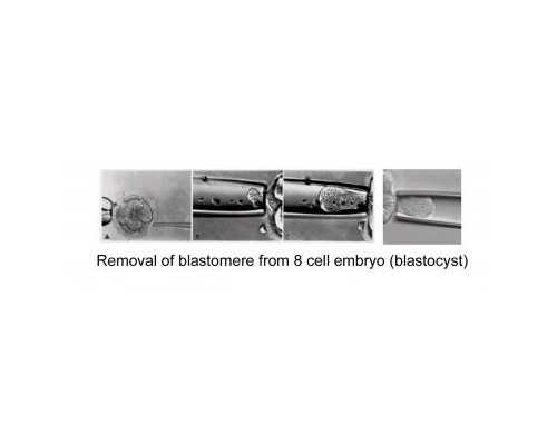 2022安徽省立医院做三代试管婴儿可以选择生男生女吗？附安徽三代医院排名