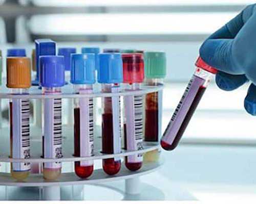 山西试管供卵选性别_掉落的食物应该如何处理？