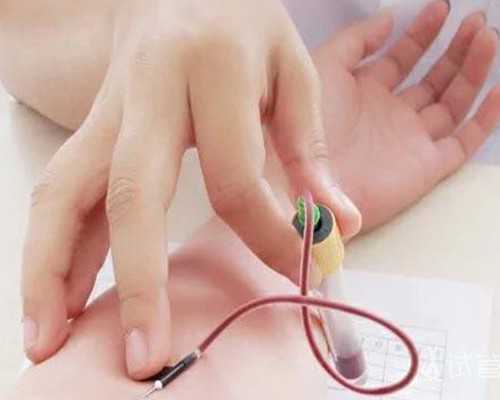 昆明代生试管生子,医疗健康●精子成活率30%在昆明能做试管婴儿吗？