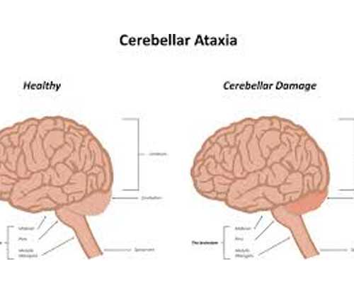 32岁AMH值多少正常，做试管婴儿成功率高吗
