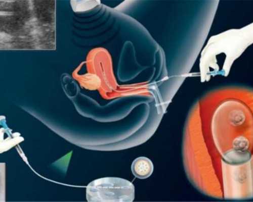 昆明代孕代怀孕助孕,北京哪里有助孕机构？怎么找，北京几大助孕机构各有何