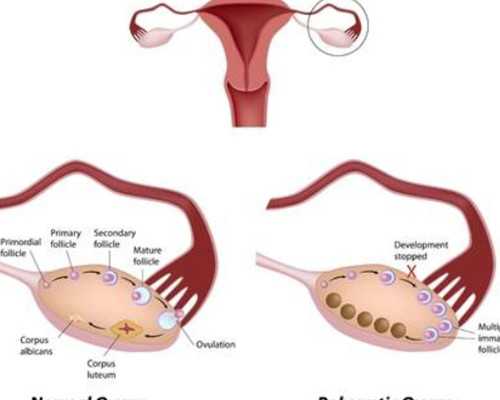 促卵泡生成素偏低能治疗吗