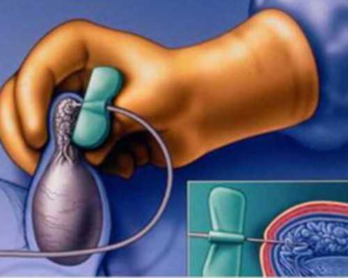 哪些人更适合做试管婴儿？影响试管成功率的关键是什么？