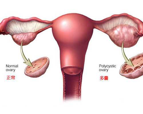 测孕纸应该怎么用，它的最佳使用时间很重要