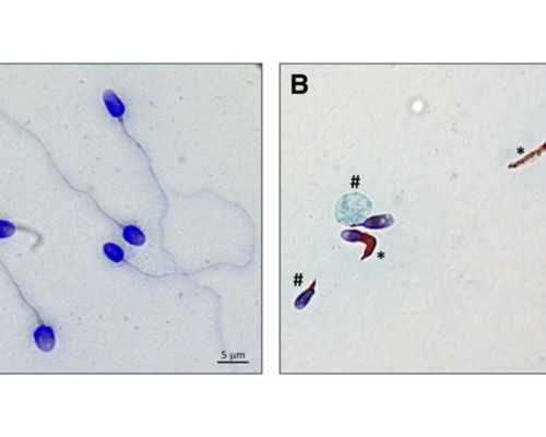 为什么做了三代试管筛查胚胎还会出现移植失败？
