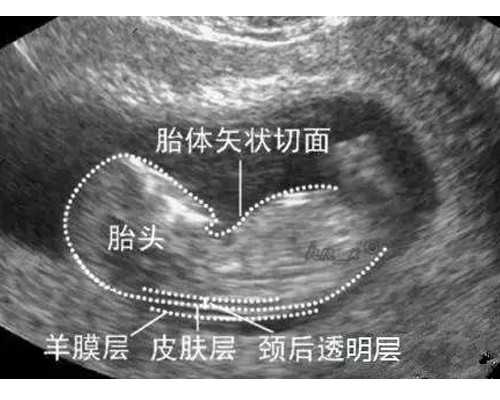 备孕中如果长期吃叶酸会不会有不良影响？