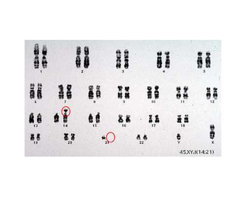 四十三岁的女人还能生孩子吗？如何备孕？