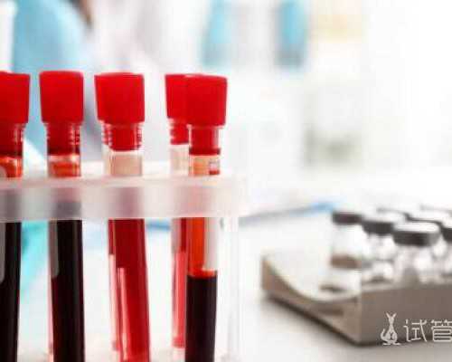 水肿、高血压不是唬你，孕妇不能吃咸菜的原因最好看看