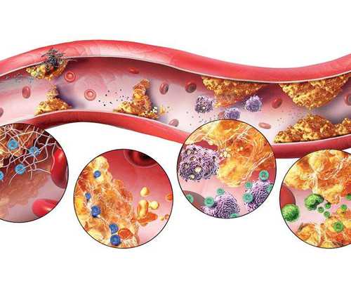 四个方法告诉你，在移植后30天流鲜血有腹痛怎么办