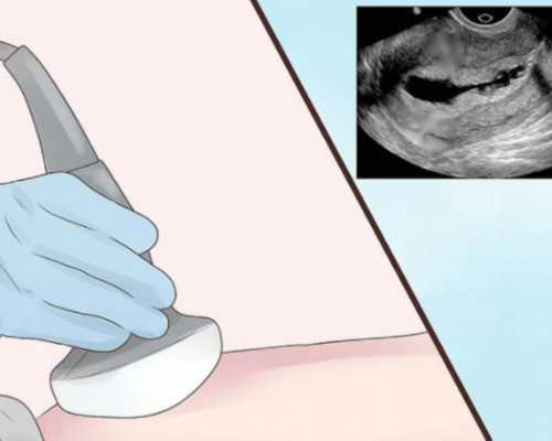 移植后不着床的6大原因是什么？你知道吗？