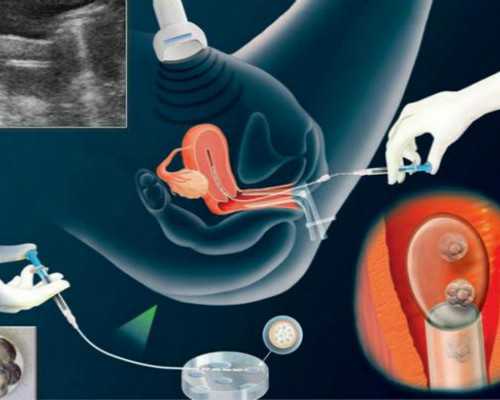 固肾安胎丸副作用
