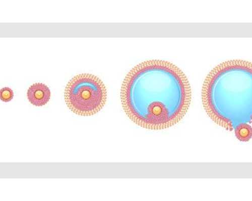  巧克力卵巢囊肿会复发吗