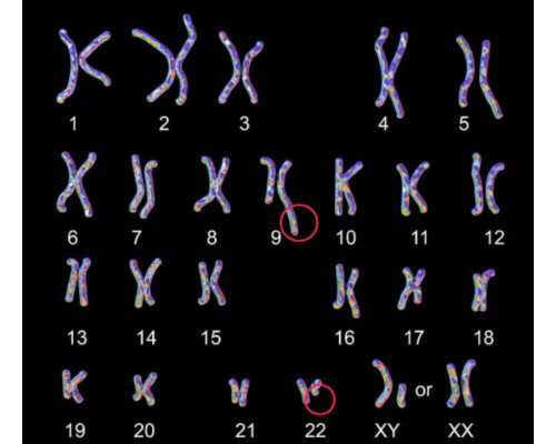 别拿豆包不当干粮！穿刺也是手术，不要忽视这些！