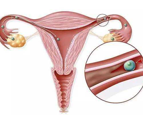 二甲双胍片是什么药_作用功效_副作用_价格_说明书