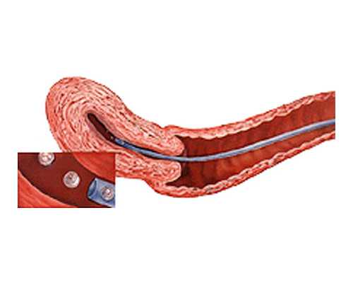 2022武汉包男孩的试管医院排名助孕费用及成功率参考