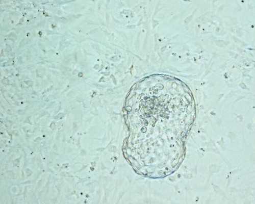 贵州供卵什么价格_【供卵所生孩子的血型】全面的孕前检查分享给大家，含价