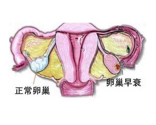 试管长方案打降调针多少钱一针？