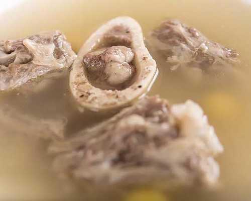 做宫腔镜检查挂什么科室