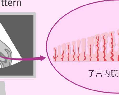 排卵期同房却怎么也没怀上，是为什么？
