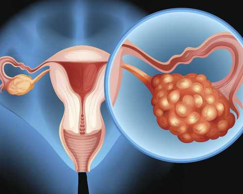 昆明代孕公司是传销吗,试管促排科普：从亲身经验谈微促和长方案的优缺点-昆