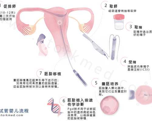 试管婴儿取完卵子之后需要注意些什么