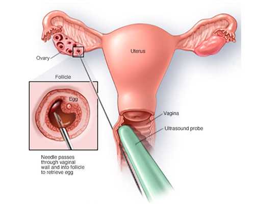 兰州供卵是什么意思_四款坚果粥满足家中小馋猫