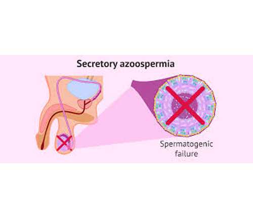 安徽试管婴儿医院top3是哪几家