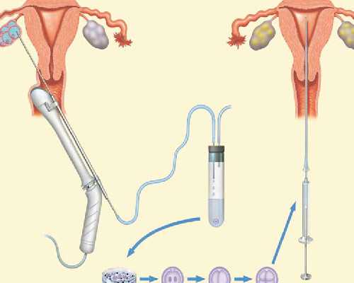 内蒙古供卵自怀费用_武汉供卵的私立医院有哪些？恳请告知我一下 ，谢谢了