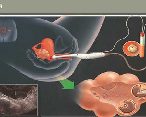 安徽省做试管可报医保吗