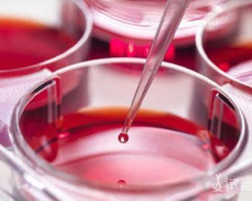 隐睾症的护理方法有哪些