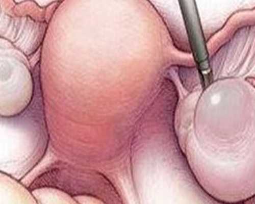 试管婴儿一代、二代、三代技术真正含义