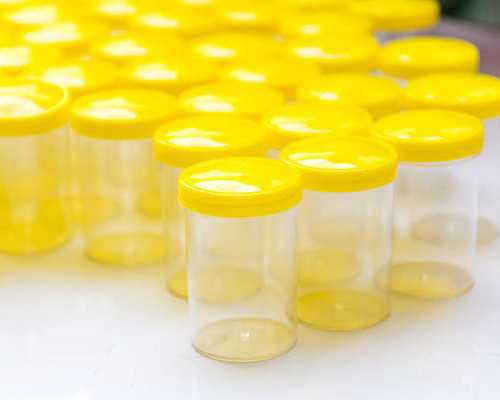 做试管婴儿要怎么做才能更省钱？（经验分享）