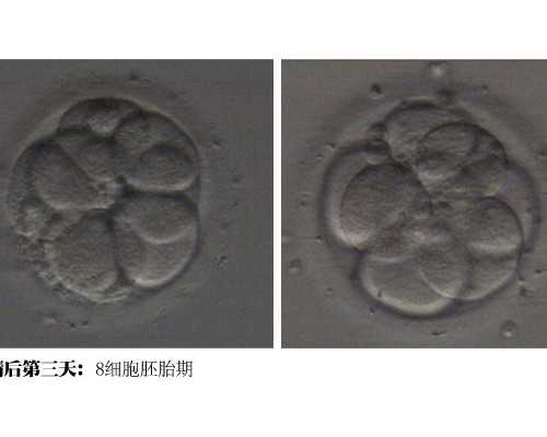 2022拉拉去泰国做试管婴儿费用是多少？