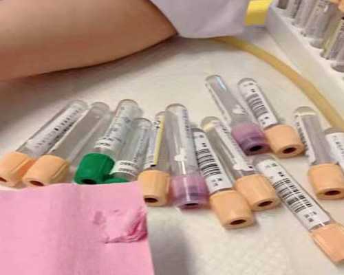 贵州三代供卵试管_新生儿脸部湿疹怎么办