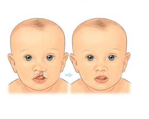 女性卵巢早衰是由于什么原因引起的