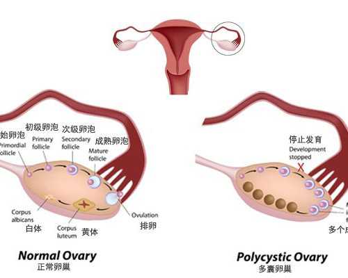 甘肃兰大一院生殖科哪个大夫技术比较好？