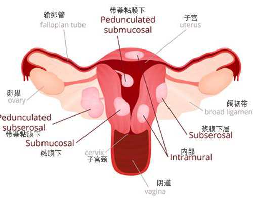 试管婴儿可以选性别吗？