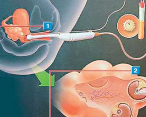 绍兴妇保做试管费用多少？试管婴儿的收费标准