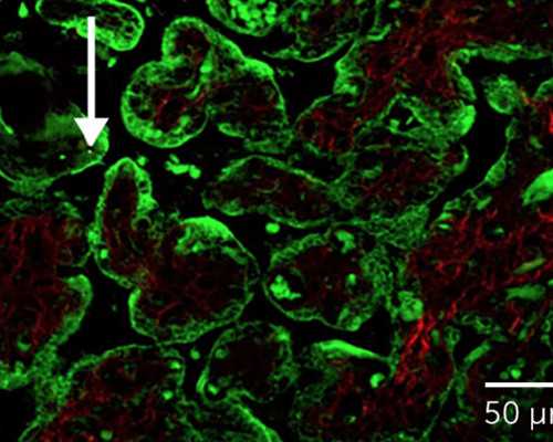 自然周期冻胚移植成功率高吗 适合哪些人