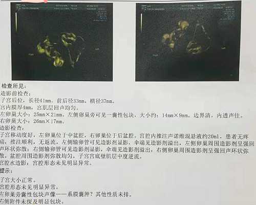 孕期杂七杂八注意事项：孕妇能吹空调吗？