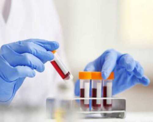 杭州国内供卵试管_测孕