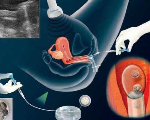 二胎备孕需要检查吗？看这个你就知道了