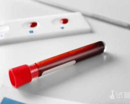 巨细胞病毒检查正常值是多少