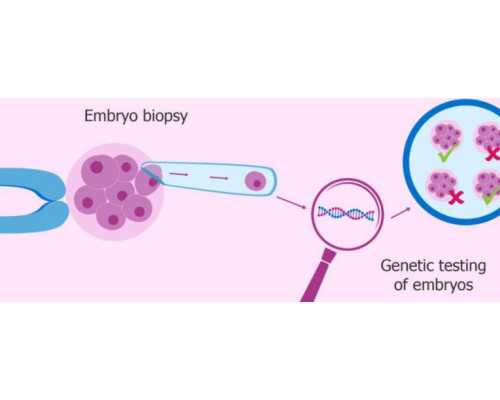 人工流产之后应该要小心做到这四点