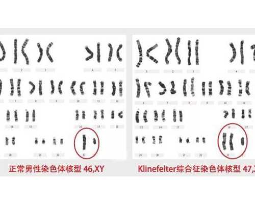 做试管婴儿前夫妻双方要做哪些准备